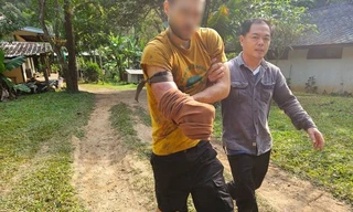 Stefan Specogna với vết thương trên tay sau khi bị gấu đen cắn. (Ảnh: ST)