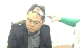 Bị chém rách đầu vì không cho nợ tiền mua nhà