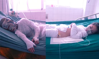 Tạt axit cả gia đình 'bạn gái' vì bị cấm yêu bé 10 tuổi