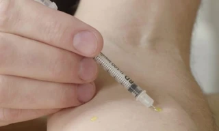 'Dị nhân' tự tiêm nọc độc rắn vào cơ thể suốt 28 năm vẫn không chết