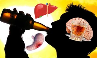 Rượu bia gây 7 loại ung thư và 200 bệnh