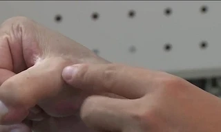 Phẫu thuật dùng ngón chân thay ngón tay cái bị dập nát