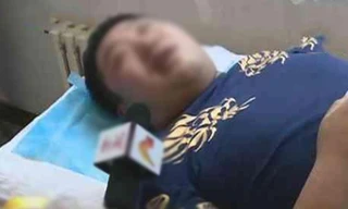 Méo miệng, mặt lệch sau một đêm vì thói quen trong ngày nắng nóng