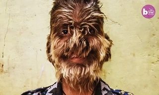 Ước mơ giản dị khó thành hiện thực của cậu bé 'ma sói'