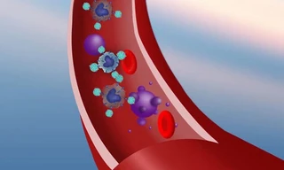 Phát minh ra cách mới diệt tận gốc tế bào ung thư