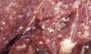 Ăn phải thịt lợn nhiễm sán có thể nguy hiểm thế nào?