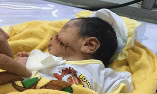 Bé trai hiện đã bình phục và được điều trị tại bệnh viện 