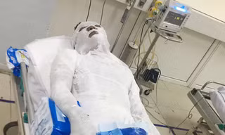 Tạm giữ đối tượng đổ xăng đốt cháy người đàn ông ở Nghệ An