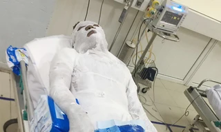 Tạm giữ đối tượng đổ xăng đốt cháy người đàn ông ở Nghệ An