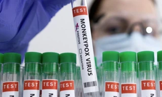 WHO chưa khuyến cáo tiêm vắc xin phòng bệnh đậu mùa khỉ cho tất cả các nhóm dân số