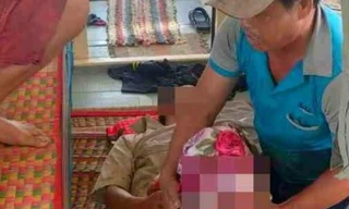 Tàu tuần tra cứu giúp ngư dân bị tai nạn mất chân trên biển