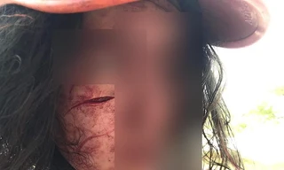 Đi làm thủ tục ly hôn, người vợ bị chồng chặn đường rạch mặt