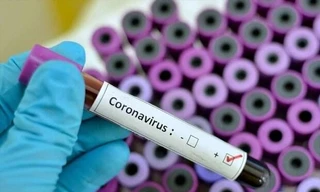 Công an xác minh 33 gói thầu mua sinh phẩm, kit xét nghiệm tại Vĩnh Phúc