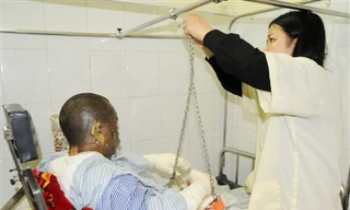 Bệnh nhân Đỗ Ngọc Mạnh (38 tuổi) bị bỏng lửa 24%, bỏng sâu 7%, bỏng hô hấp. Ảnh: Tuấn Nguyễn