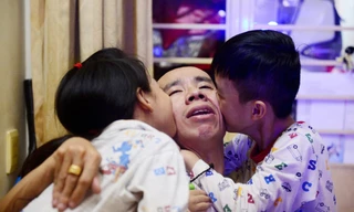 Cặp song sinh dính liền Việt - Đức sau 28 năm mổ tách rời