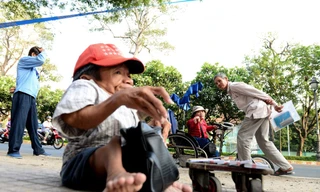 Chuyện đời anh em 'sọ dừa' bán vé số ở Sài Gòn