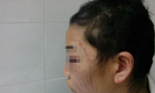 Mẹ trẻ bị hành hạ dã man vì một tin nhắn tình cảm?