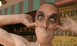 Người có da kéo giãn như kẹo cao su