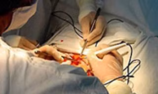 Tự bơm tăng kích cỡ 'cậu nhỏ', 40 trai làng nhập viện