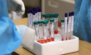 Hà Nội ghi nhận thêm ca dương tính SARS-CoV-2 ngày 28 Tết