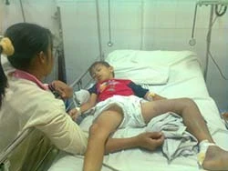 Trèo lên hái mận bất ngờ bị rắn lục cắn nguy kịch