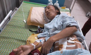 Thể trạng bệnh nhân yếu nhưng cũng đã đang quá trình khôi phục.