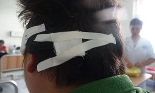 Ông Phổ điều trị tại bệnh viện.