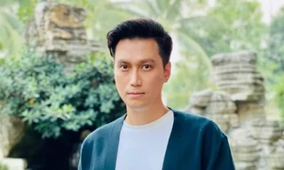 Diễn viên Việt Anh lại lộ nhan sắc khác lạ hậu phẫu thuật thẩm mỹ