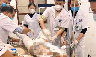 Người đàn ông tự thiêu vì mâu thuẫn với vợ