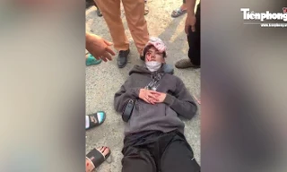 Khởi tố đối tượng dùng gậy cao su vụt người dân lõm xương sọ, thương tích 44% gần chốt 141