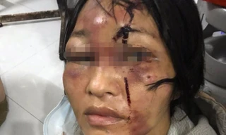 Gã ‘chồng hờ’ đánh đập vợ con tàn bạo