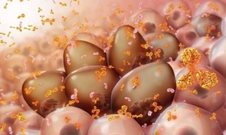 Điều trị ung thư máu bằng xét nghiệm gien hiệu quả tới 40 lần