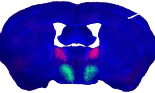 Tìm được tế bào thần kinh ham muốn tình dục ở người? 