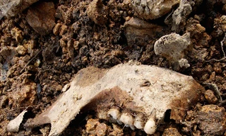 Phát hiện cả nghìn răng người giấu trong bức tường nhà ở Mỹ