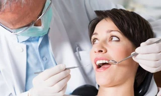 Mang họa vì tẩy trắng răng sai cách