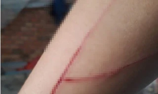 Sự thật thông tin 'nạn nhân vụ giao cấu với trẻ em bị chém trên đường'