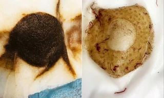 Giun sán xuất hiện trong nước sinh hoạt của cư dân KĐT Pháp Vân - Tứ Hiệp