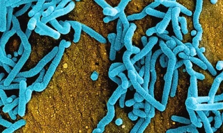 Virus Marburg gây tử vong cao nhưng không dễ lây 