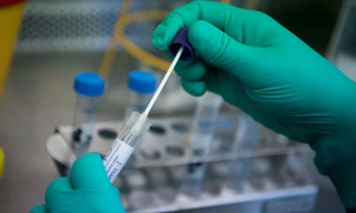 Ca mắc tăng, biến thể Omicron chiếm đa số 