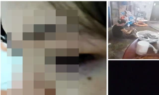 Xác minh thông tin một phụ nữ bị chồng và mẹ chồng đánh nhập viện