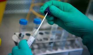 Kit test nhanh COVID-19 được rao bán tràn lan trên mạng xã hội 