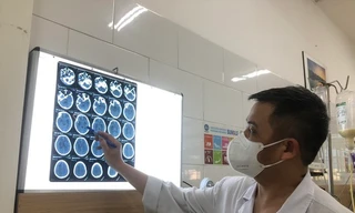 37 công nhân bị nhiễm độc methanol, một trường hợp tử vong