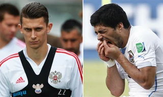 Hậu vệ Nga không sợ bị Luis Suarez... cắn