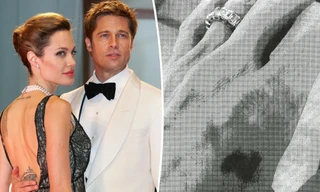 Lộ ảnh chụp thương tích của Angelina Jolie trong vụ xô xát với Brad Pitt trên máy bay