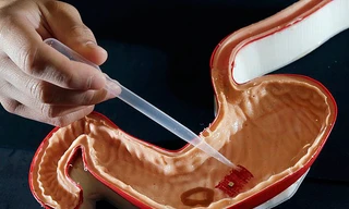 Milirobot - Robot siêu nhỏ hoạt động trong cơ thể người