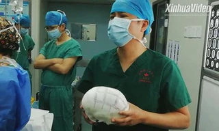 Công nghệ in 3D giúp cứu sống trẻ sơ sinh ở Trung Quốc