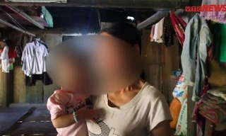 Xót xa bé 18 tháng tuổi bỗng nhiên phát hiện nhiễm HIV