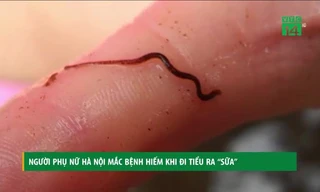 Người phụ nữ Hà Nội mắc bệnh hiếm đi tiểu ra 'sữa'