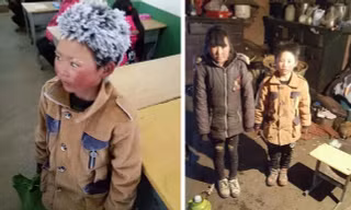 Cậu bé có mái tóc đóng băng ở Trung Quốc được ủng hộ hàng triệu USD