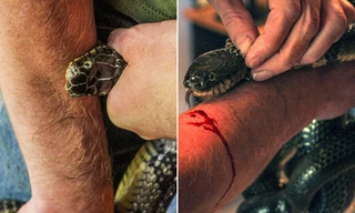'Dị nhân' có sở thích cho rắn độc cắn, tự tiêm nọc rắn vào cơ thể